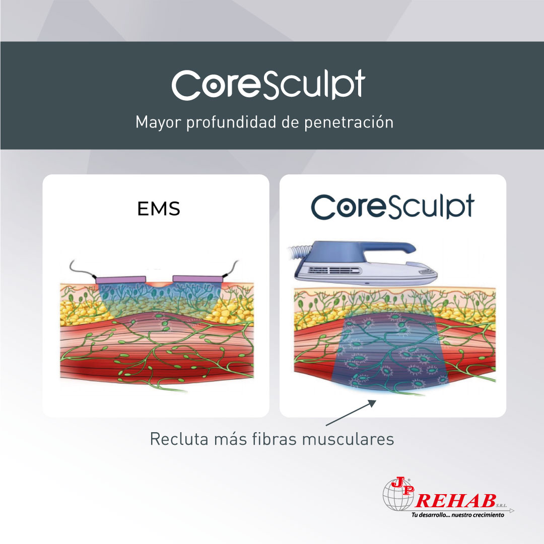 icono de color del estimulador muscular eléctrico. dispositivo de  crecimiento de los músculos del pecho. equipo de mioestimulación. ems.  Estimulación nerviosa eléctrica transcutánea. terapia física. ilustración  vectorial aislada 8744244 Vector en Vecteezy